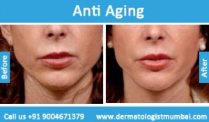 anti-aging-treatment-before-after-photos-in-mumbai-india-5